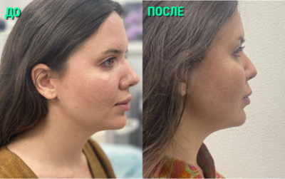 mycollages-6-1-400x251