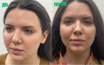 mycollages-8-400x251
